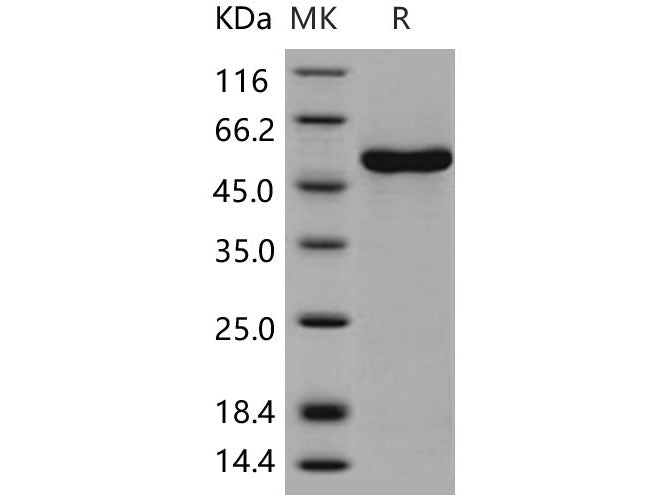 Recombinant Human CCNA1/Cyclin-A1 Protein (His Tag)(Active)