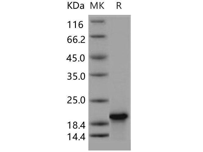 Recombinant Human Troponin C/TNNC1 Protein