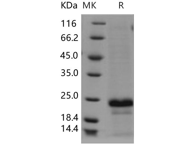 Recombinant Human CD20/MS4A1 Protein (aa 213-297, His Tag)