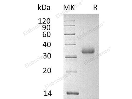 Recombinant Human CD2 Protein (His Tag)(Active)