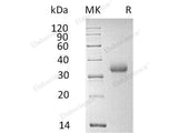 Recombinant Human CD2 Protein (His Tag)(Active)