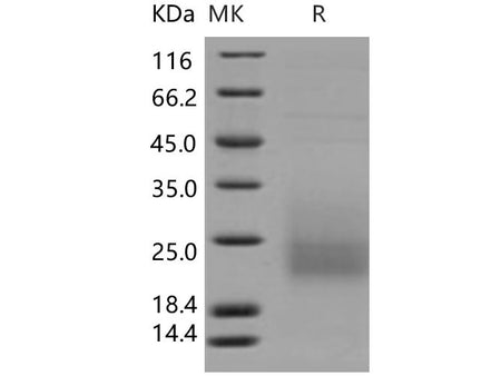 Recombinant Human CD3d/CD3 delta Protein (His Tag)