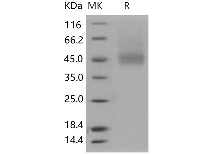 Recombinant Human IL7RA/CD127 Protein (His Tag)(Active)