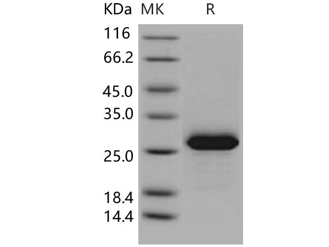 Recombinant Human MESDC2/MESD Protein (His Tag)