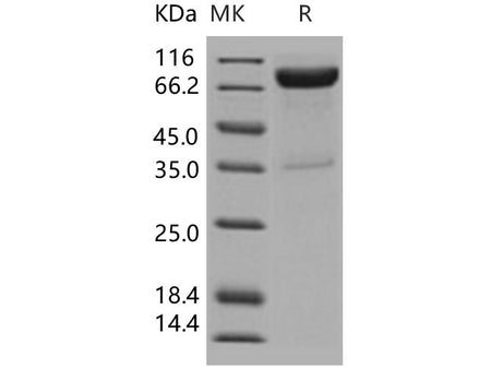 Recombinant Human IL10RB/IL10R2 Protein (His & Fc Tag)(Active)