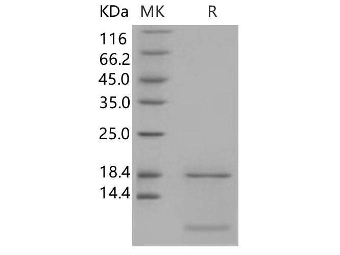 Recombinant Human S100A6 Protein