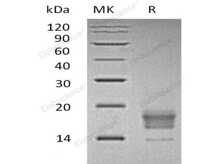 Recombinant Human TIGIT Protein (aa 1-138, His Tag)(Active)