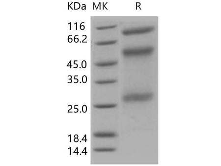Recombinant Human ADAM12 Protein (His Tag)(Active)