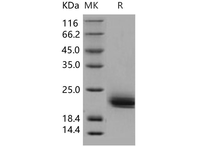 Recombinant Human LAIR2/CD306 Protein (His Tag)(Active)