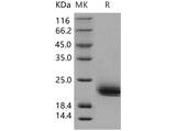 Recombinant Human LAIR2/CD306 Protein (His Tag)(Active)