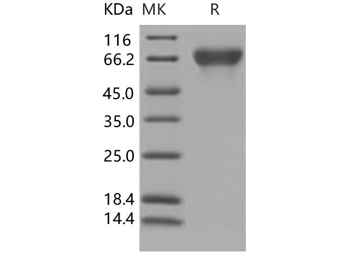 Recombinant Human Nectin-3/PVRL3 Protein (His Tag)(Active)