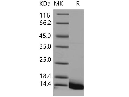 Recombinant Human Defensin/Beta-defensin 3/DEFB103 Protein (His Tag)