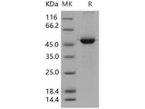Recombinant Human 14-3-3 sigma/YWHAS Protein (GST Tag)