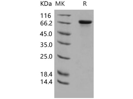 Recombinant Human HPRG/HRG Protein (His Tag)(Active)