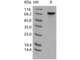 Recombinant Human HPRG/HRG Protein (His Tag)(Active)