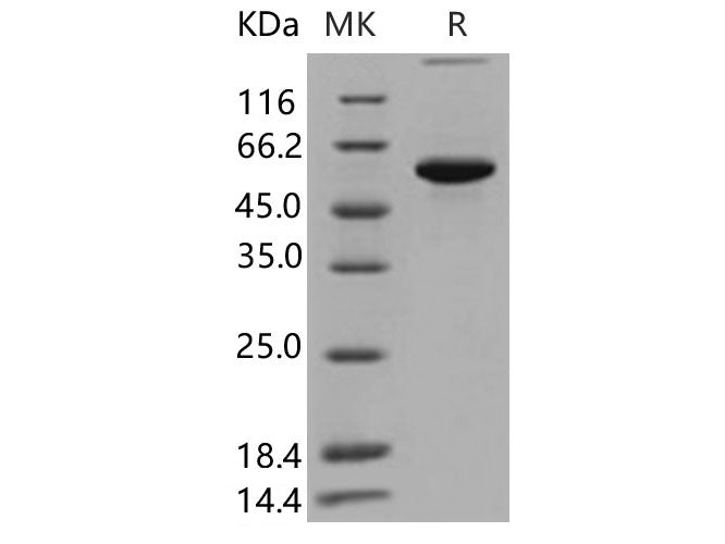 Recombinant Human P4HB Protein (His Tag)(Active)