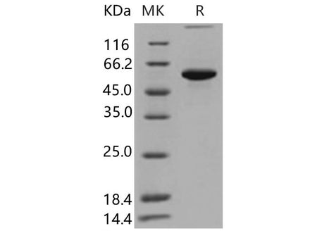 Recombinant Human P4HB Protein (His Tag)(Active)
