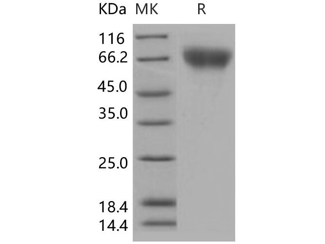Recombinant Human FGFR2/CD332 Protein (His Tag)(Active)