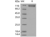 Recombinant Human FGFR2/CD332 Protein (His & Fc Tag)(Active)