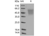 Recombinant Human CEACAM6/CD66c Protein (His Tag)(Active)