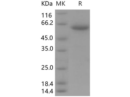 Recombinant Human CLEC10A/CD301 Protein (Fc Tag)
