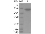 Recombinant Human CLEC10A/CD301 Protein (Fc Tag)
