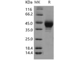 Recombinant Human SCARB3 Protein (His & FLAG Tag)