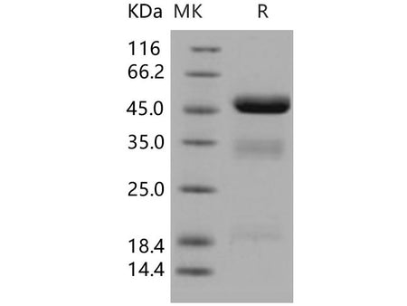 Recombinant Human Urokinase/uPA Protein (His Tag)(Active)