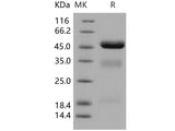 Recombinant Human Urokinase/uPA Protein (His Tag)(Active)