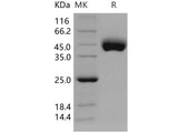 Recombinant Human CD21/CR2/C3DR Protein (His Tag)(Active)