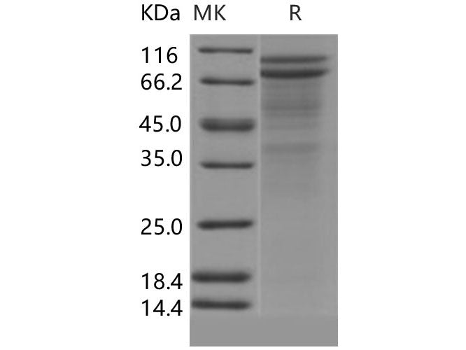 Recombinant Human DSC2/Desmocollin-2 Protein (His Tag)