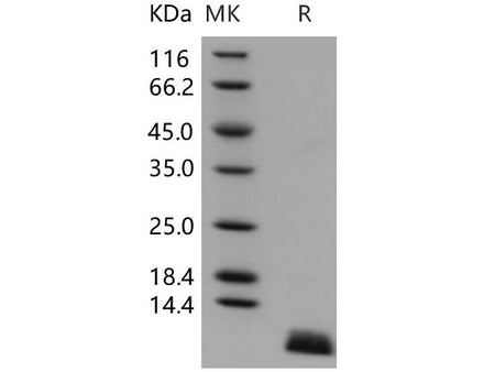 Recombinant Human Uteroglobin/SCGB1A1 Protein (His Tag)(Active)