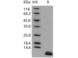 Recombinant Human Uteroglobin/SCGB1A1 Protein (His Tag)(Active)