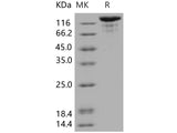 Recombinant Human VEGFR3/FLT4 Protein (Fc Tag)(Active)