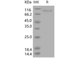 Recombinant Human CD10/Neprilysin Protein (Active)