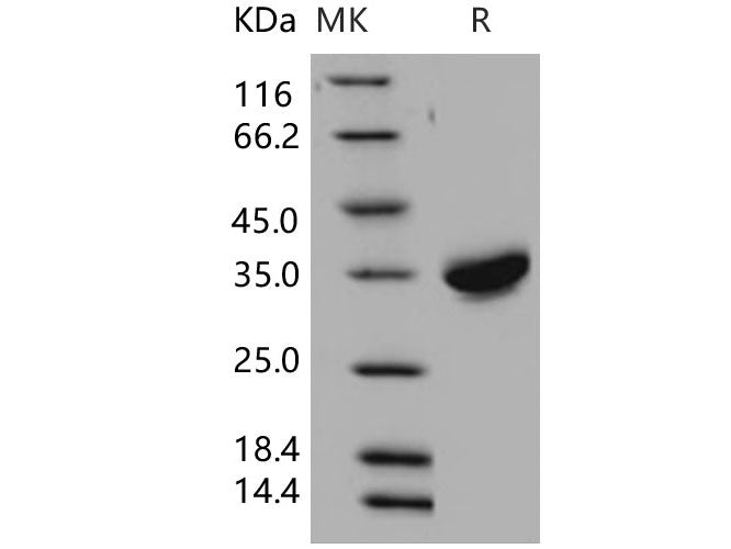 Recombinant Human CXADR/CAR Protein (His Tag)(Active)