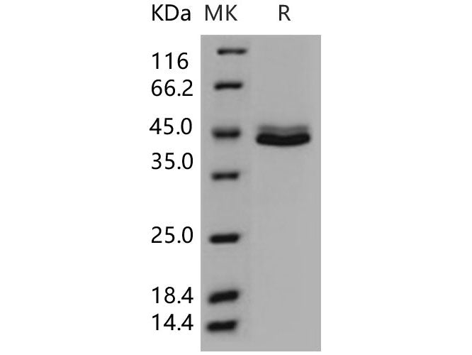 Recombinant Human CCD5L Protein (His Tag) 