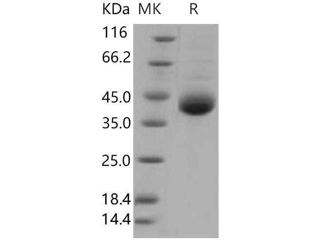 Recombinant Human Kallikrein 11/KLK11 Protein (His Tag)(Active)