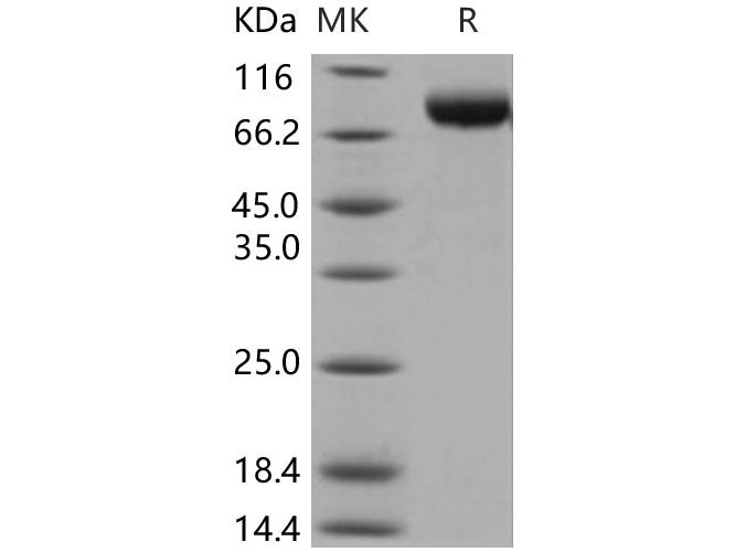 Recombinant Human MICB Protein (His & Fc Tag)(Active)