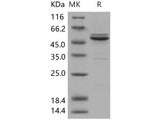 Recombinant Human JNK2/MAPK9 Protein (His Tag)