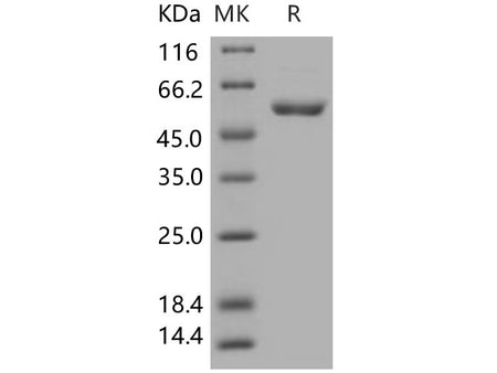Recombinant Human CDC2 Kinase/CDK1 Protein (GST Tag)