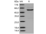 Recombinant Human CDK4 Protein (GST Tag)