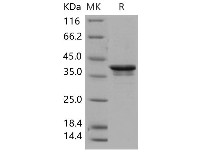 Recombinant Human PDK/PDZ binding kinase/TOPK Protein (His Tag)