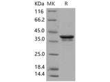 Recombinant Human PDK/PDZ binding kinase/TOPK Protein (His Tag)