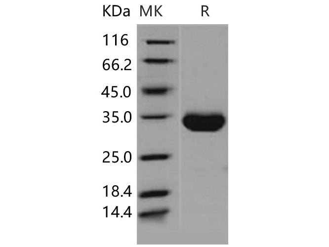 Recombinant Human EPO Receptor/EPOR Protein (His Tag)(Active)