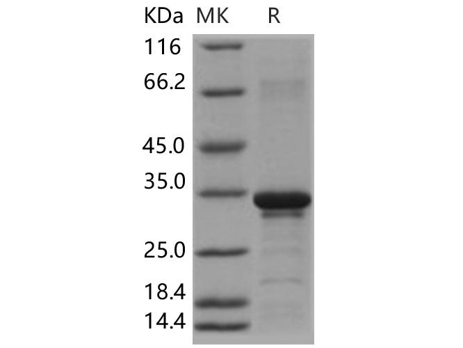 Recombinant Human Beta-amyloid 38/Beta-APP38 Protein (aa 672-709, His & GST Tag)