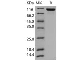 Recombinant Human Tie2/CD202b Protein (His Tag)(Active)