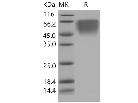 Recombinant Human CD86/B7-2 Protein (aa 1-239,His Tag)(Active)