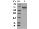 Recombinant Human CD122/IL-2RB Protein (Fc Tag)(Active)