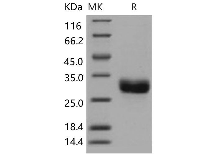 Recombinant Human ULBP1/N2DL1 Protein (His Tag)(Active)